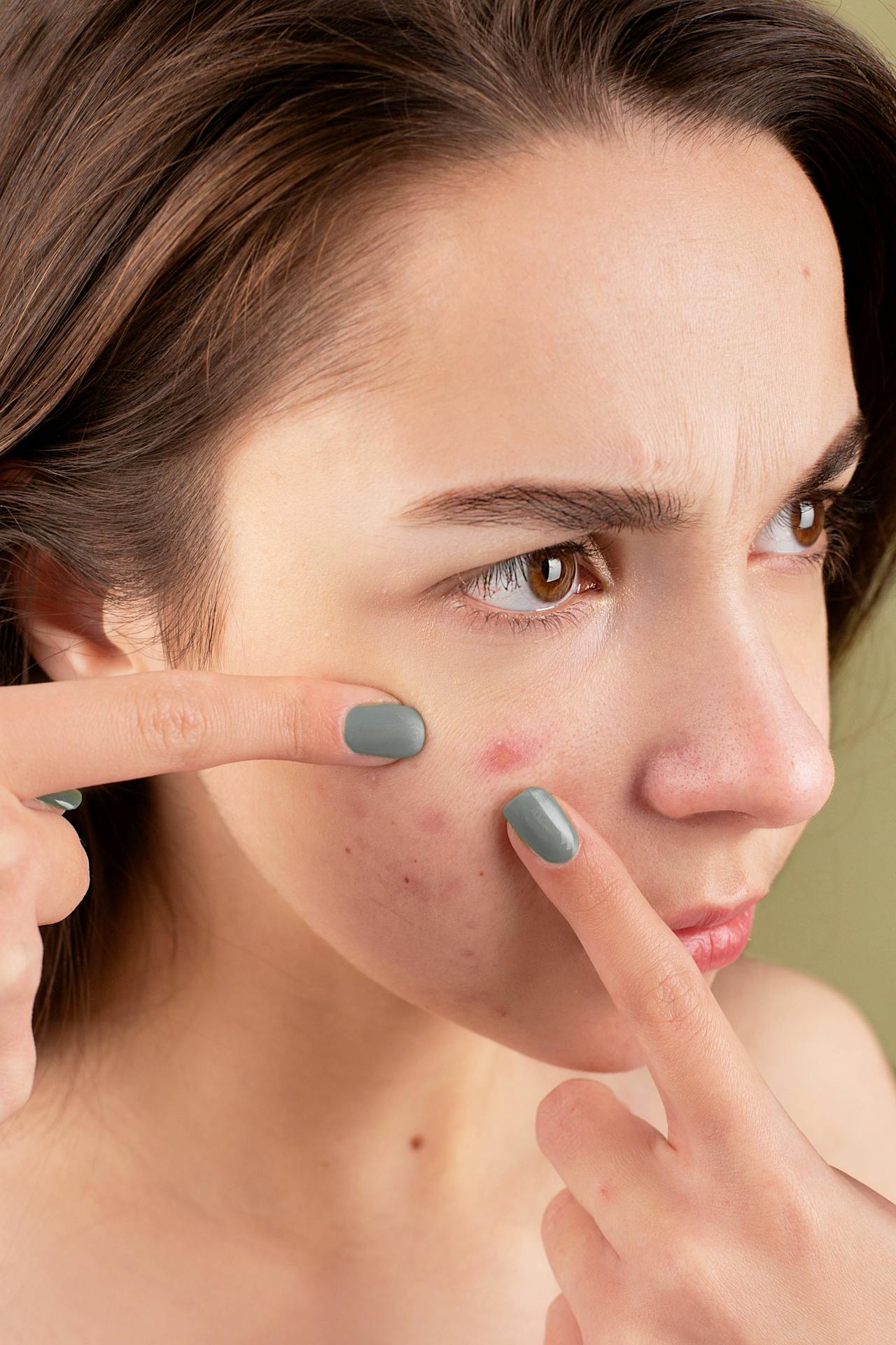Skincare Before